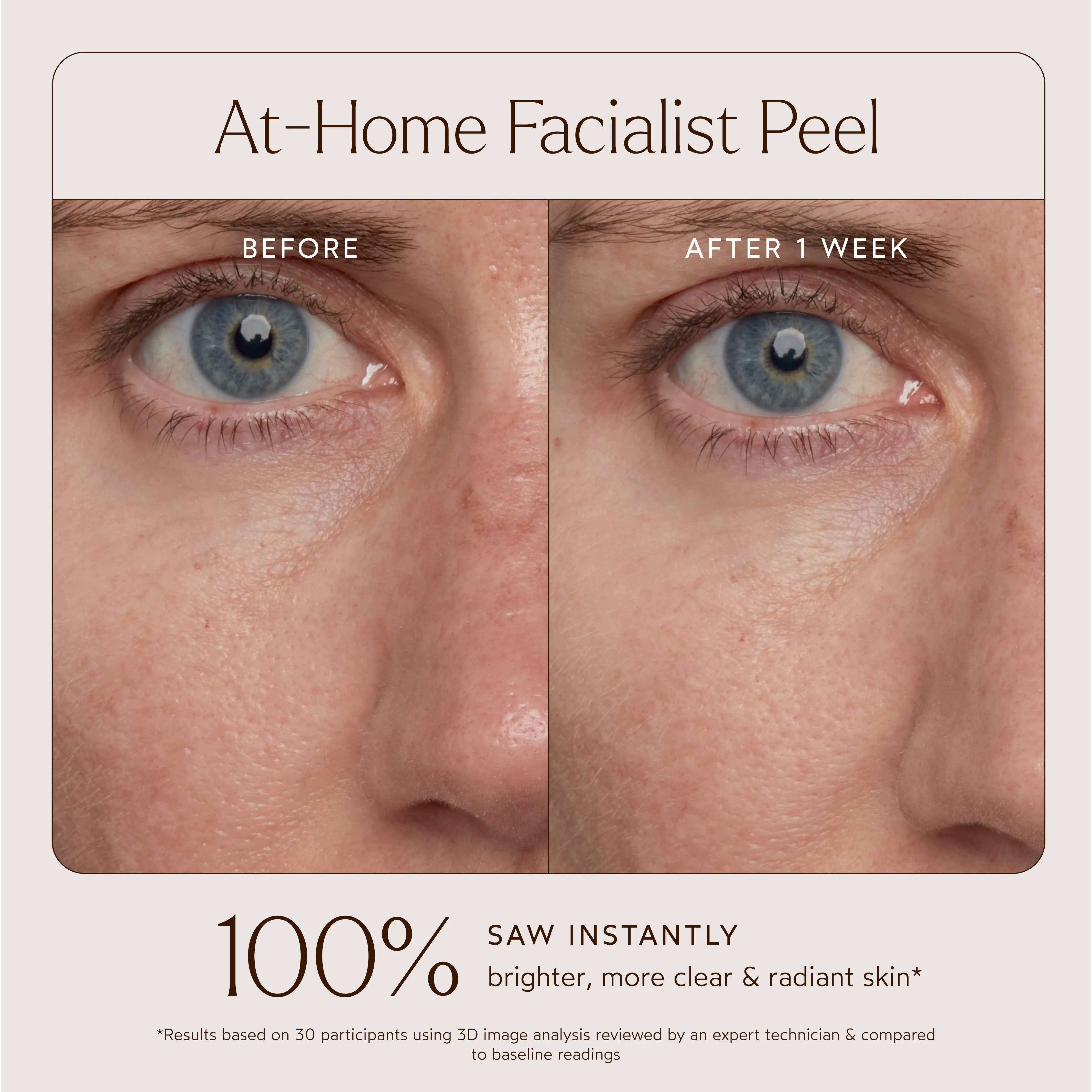 At-Home Facialist Peel