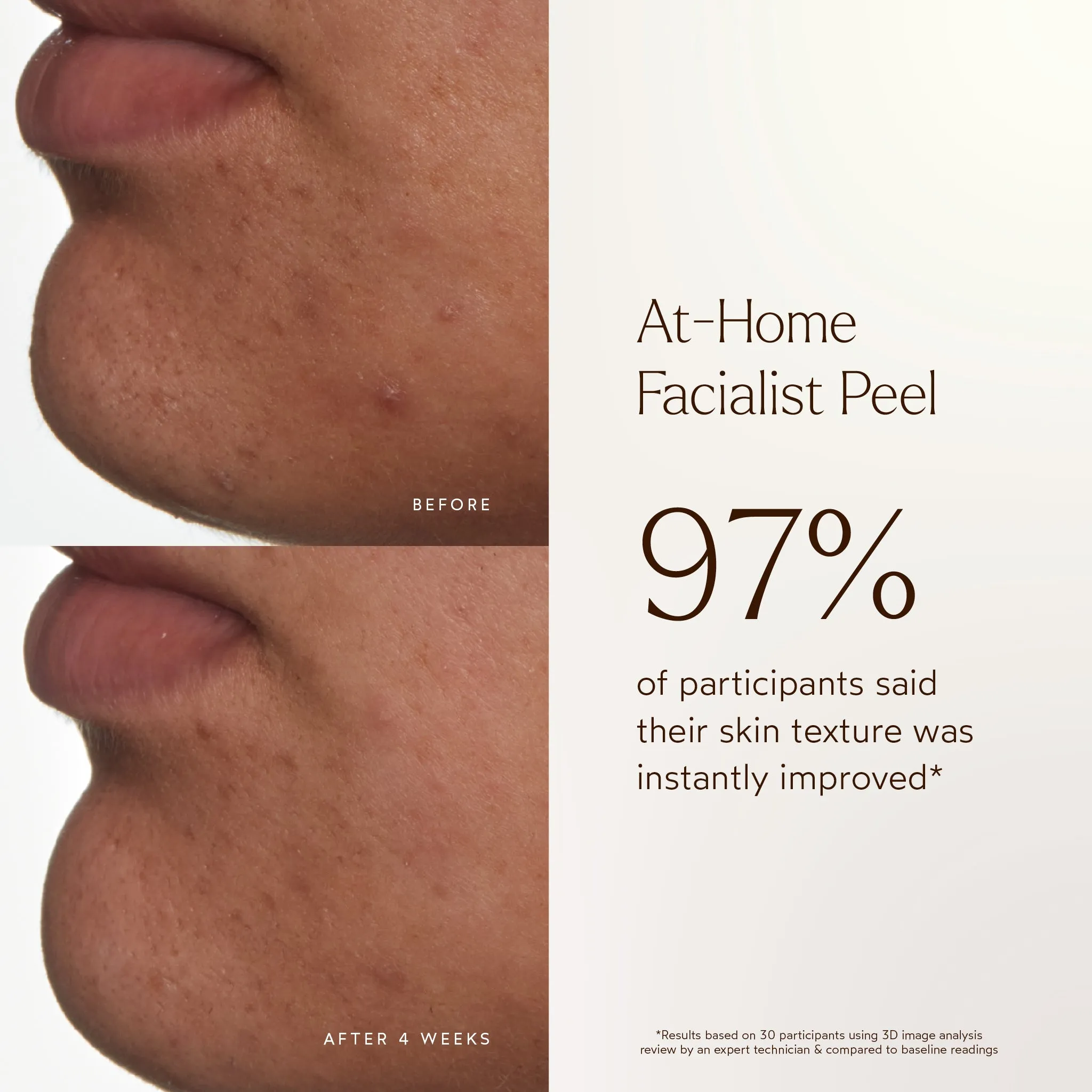 At-Home Facialist Peel